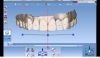 Dental  cad/cam kurs hocas