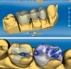 Dental cad/cam  tecrbeli personeli